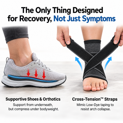 Cross Tension Arch Sleeve™