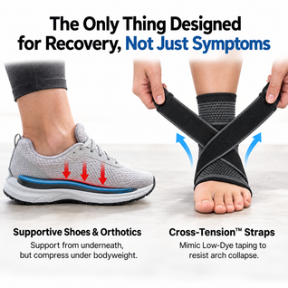 Cross Tension Arch Sleeve™