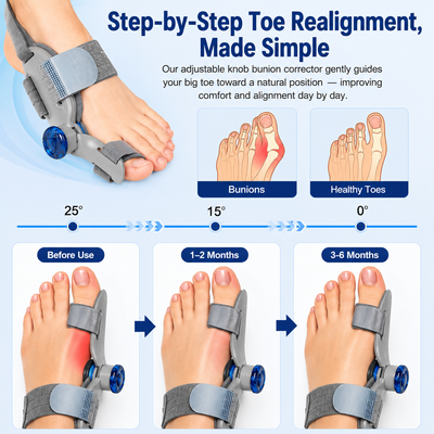 Bun-ease™ - Bunion Corrector for Pain Relief & Straightening